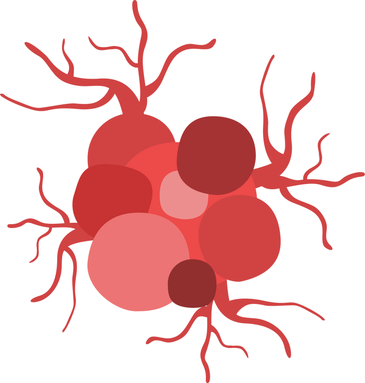 cancer cell growth. cancer disease concept